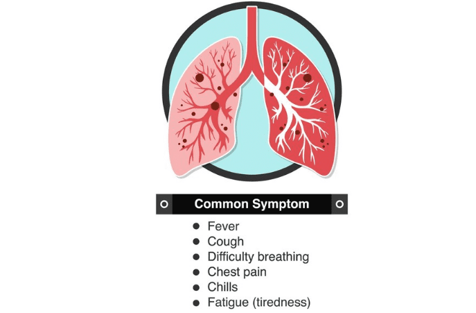 signs of multifocal pneumonia